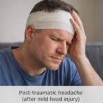 Order Fioricet Online after Post-Traumatic Headache POST TRAUMATIC HEADACHE