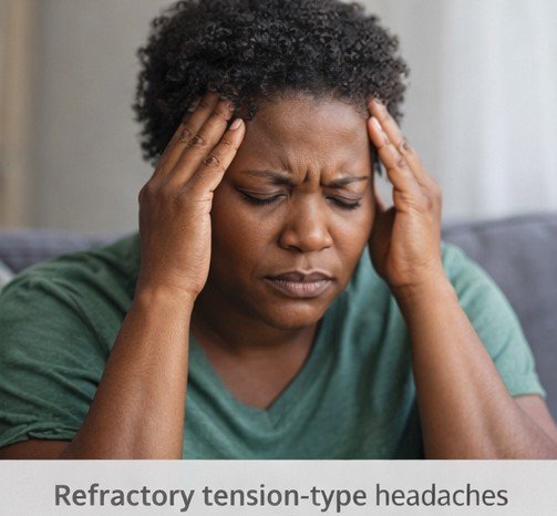 Buy Fioricet Online for Refractory Tension Headache